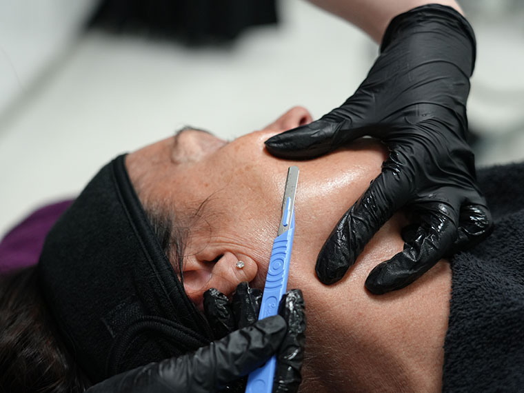 A student doing a Dermaplane treatment on a client